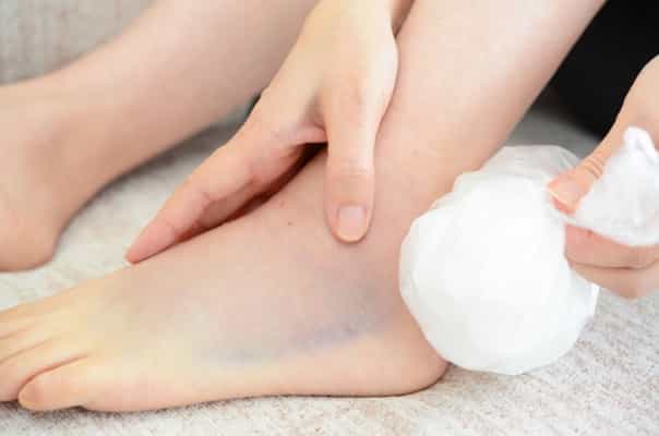  The Hidden Danger: Stress Fracture Top of Foot Symptoms Every Runner Should Watch Out For